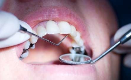 Paciente con odontología con metales.