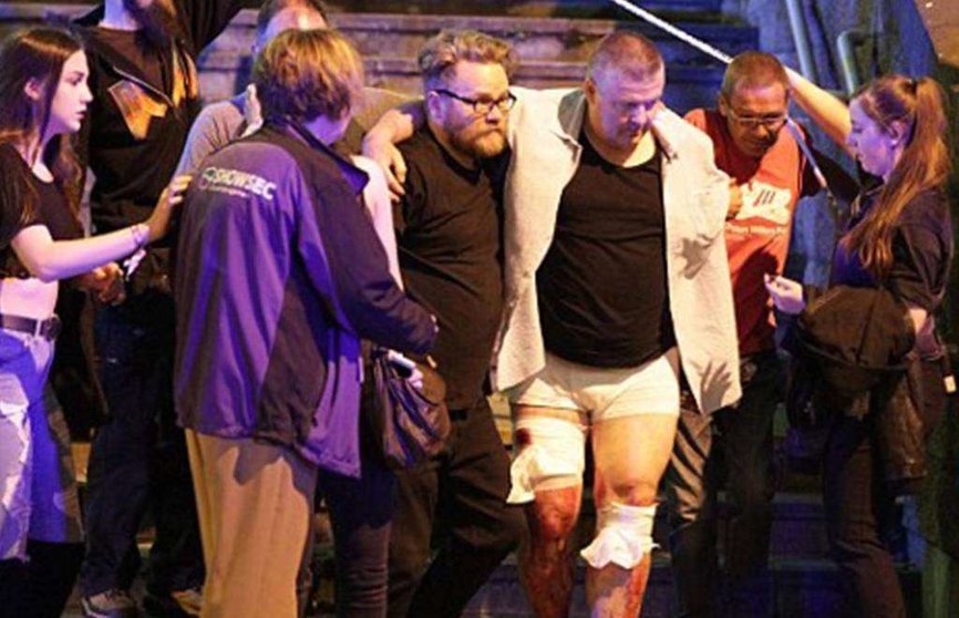 Uno de los heridos en el atentado ocurrido en Mánchester.