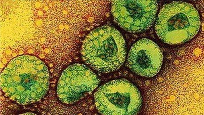 Coronavirus Mers. (Fuente externa)